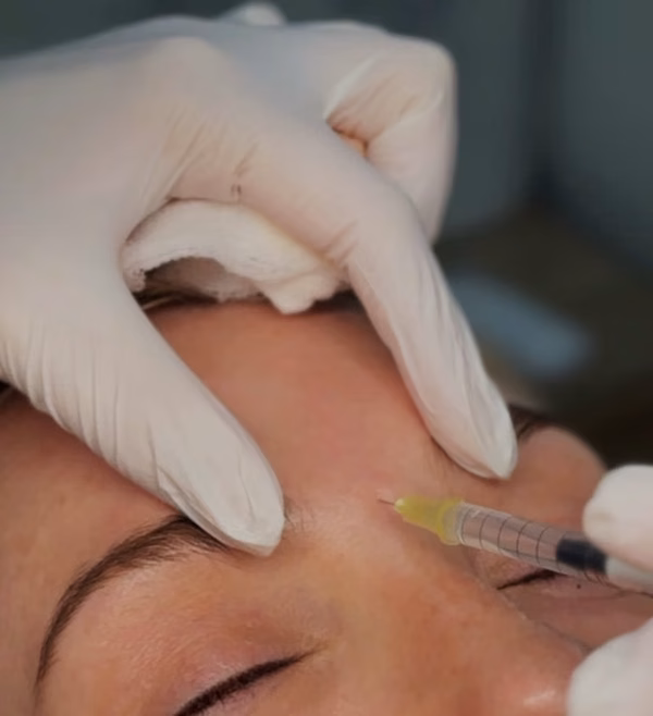 Botox Treatment
